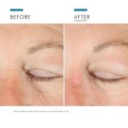 SkinCeuticals A.G.E. Hochentwickelte Augenpflege gegen Augenringe & Fa...